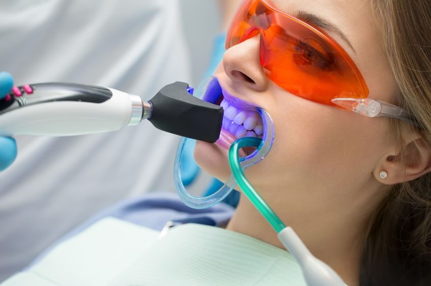 Una paziente durante lo sbiancamento dentale con la lampada